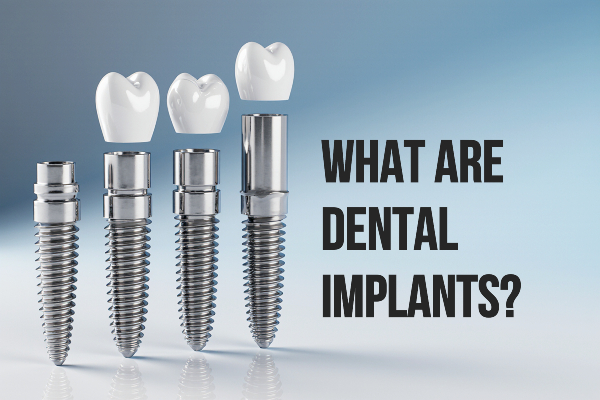ատամնային-իմպլանտ-зубной-имплант-dental-implants