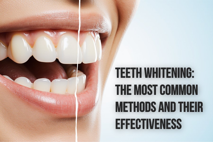 ատամների-սպիտակեցում-отбеливание-зубов-teeth-whitening