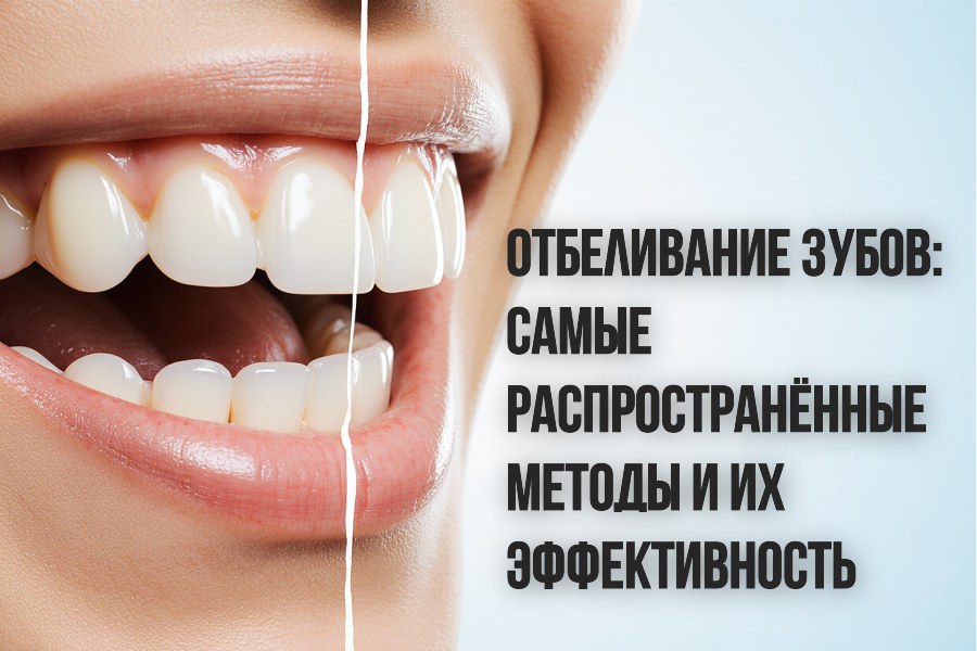 отбеливание зубов
